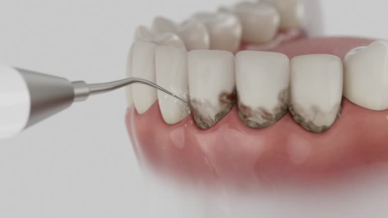 Reliable Dental contractor in California, MD by Dentist Open Now